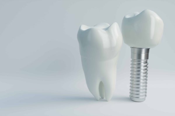 AdobeStock_246491662-new Pine Ridge Dental Zimmerman, Minnesota